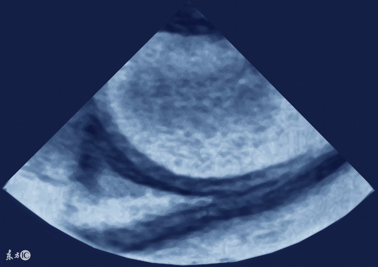 哪些疾病会腹水,什么样的癌症肚子里有水