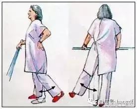 髋关节置换术后引流管的护理,髋关节置换围手术期护理ppt