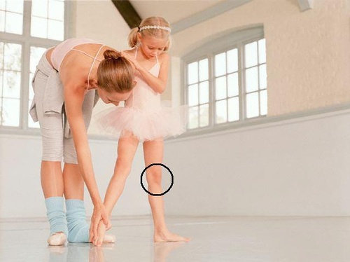 怎样改善x腿型和o腿型,通过调整脚型来改善x型腿