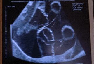 什么时候能“看”到胎动？不同月份胎动有不同感觉