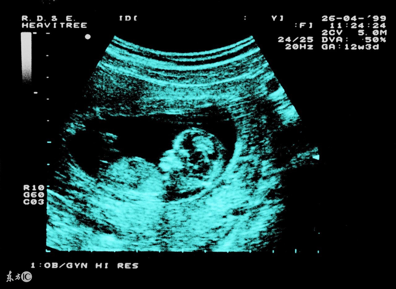 孕妇胎位不正做什么动作矫正视频,胎位不正有必要做扭转法吗