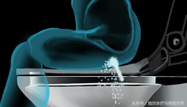 孕妇得了痔疮生活中需要关注什么,得了血栓性痔疮应该关注什么