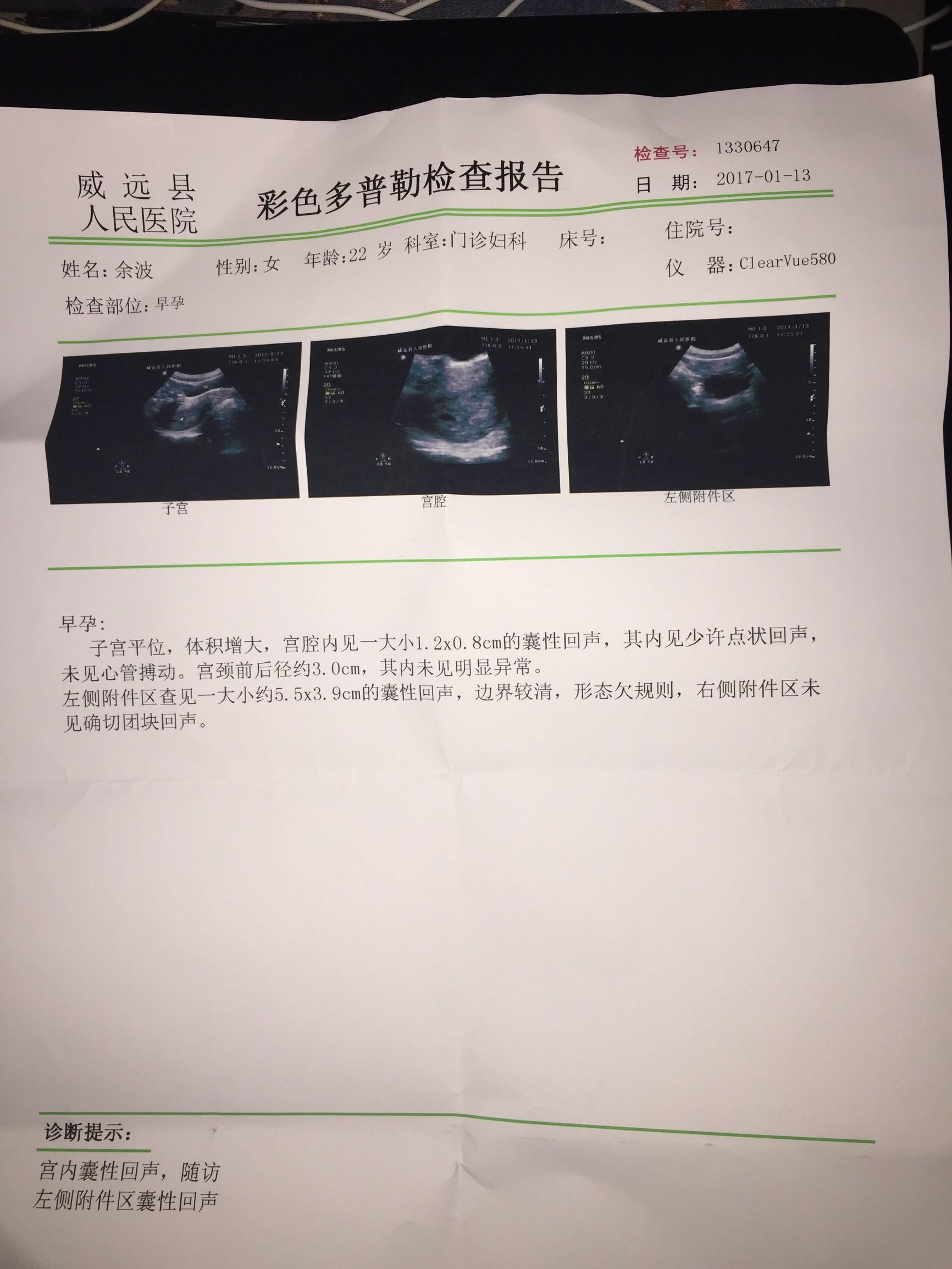 孕期一周到40周的变化,孕期1周到40周肚子变化图
