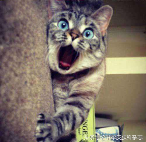 手部发黑怎么回事,摩擦性黑变病的症状有哪些