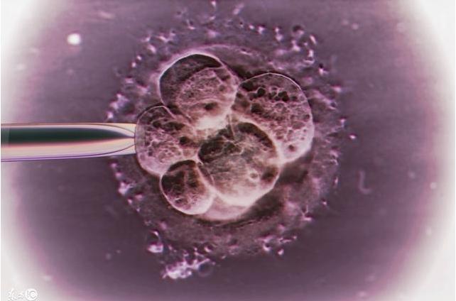 38岁女人做试管婴儿,女人做试管婴儿流程