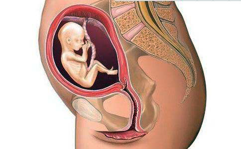 顺产还是剖谁决定,顺产痛苦还是剖宫产痛苦