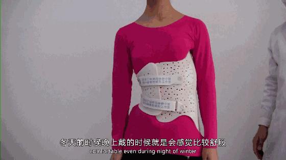 案例l3D打印支具助力青少年脊柱侧弯保守治疗
