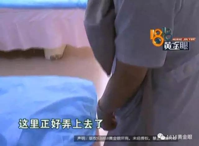 割完双眼皮，头发被胶水粘住！看监控，发现同行的闺蜜有可疑动作