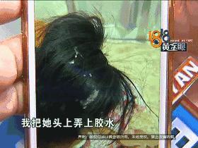 割完双眼皮，头发被胶水粘住！看监控，发现同行的闺蜜有可疑动作