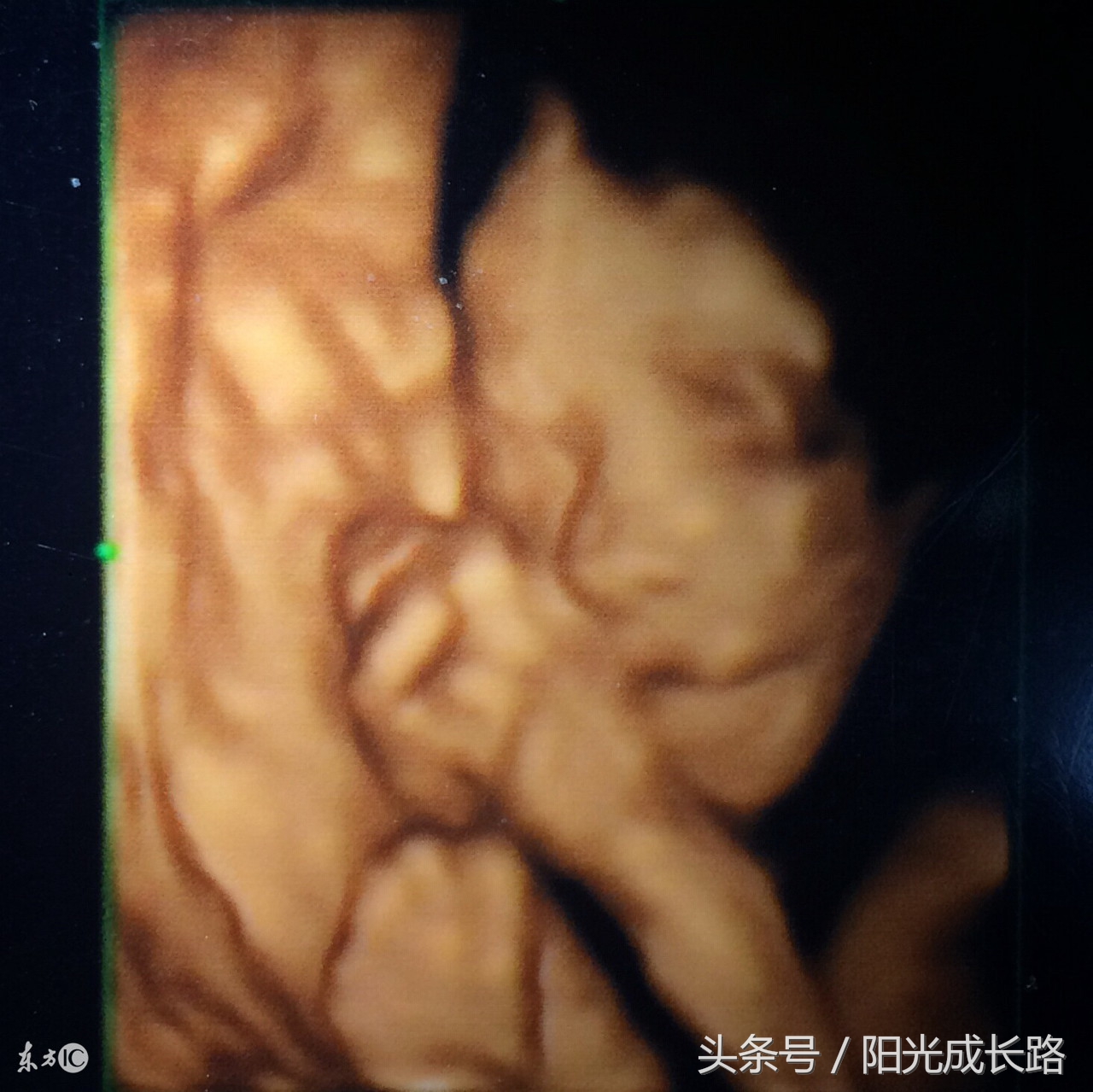 孕妇做系统b超和四维彩超一样吗,孕期做彩超都查什么项目