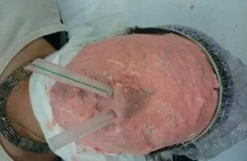 究竟是咋插进去的我出100你再重头插一次让我看看