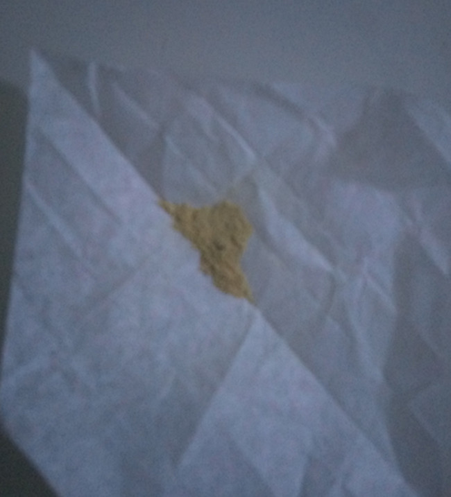 宝宝鹅口疮怎么治,宝宝得鹅口疮怎么办