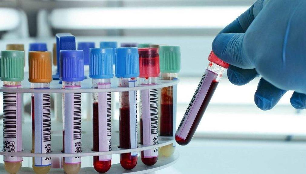 丙肝抗病毒药物,丙肝抗病毒的关注事项