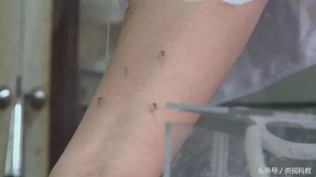 活了30年才知道防蚊妙招,科学防蚊