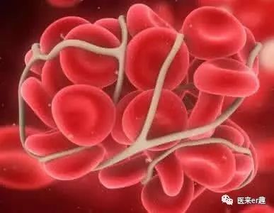 备孕新生儿溶血检测,abo溶血备孕可以中药调理吗