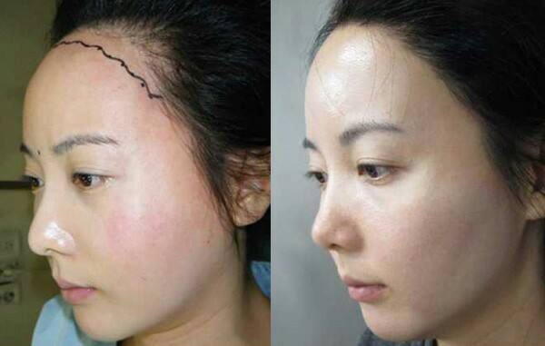 露额头好看的人适合留什么发型,露额头好看是属于什么脸型