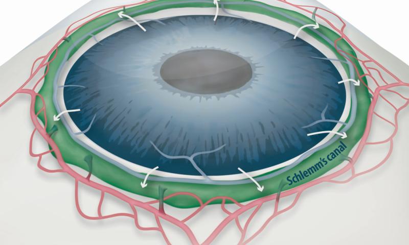 日本治疗青光眼的新研究,青光眼视神经最新研究