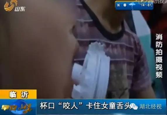 6岁宝宝喝水，不慎将舌头卡住瓶盖至血肿僵硬