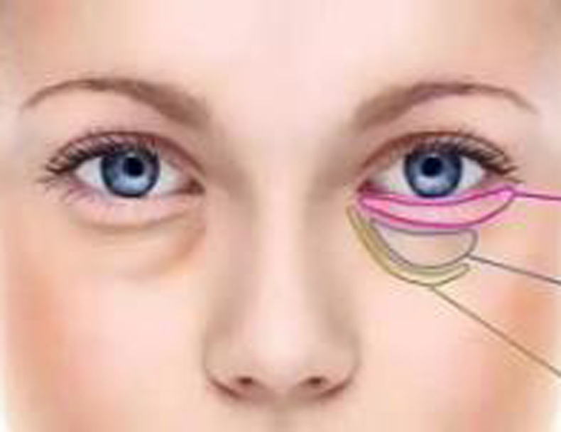 去除黑眼圈眼袋最有效的眼霜,去除眼袋黑眼圈最有效的方法