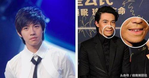 俞灏明被说丑悲伤,俞灏明烧伤后是怎么恢复的