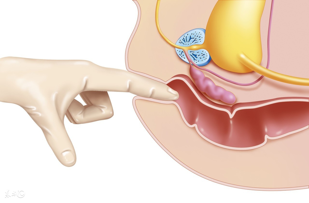 早上起床很急着要上厕所，但是上厕所却很难尿出来，这是为什么？