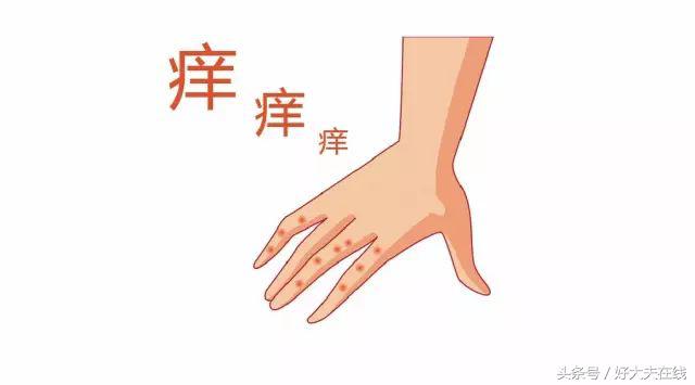 手上起小水泡是什么病,手上长小水泡一挤就流水是什么病