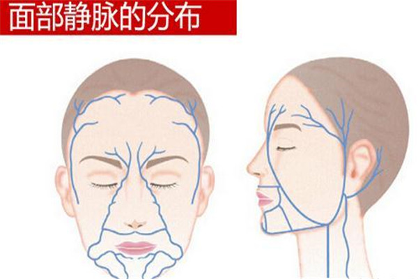 一颗痘引发的惨案,50岁大叔突发心梗命悬一线