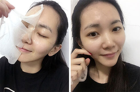 跟我这样做，不出3个月，痘痘全消散