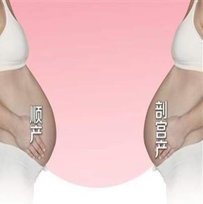 妊娠疤痕怀孕应关注什么,疤痕子宫怀孕怎样避免疤痕妊娠