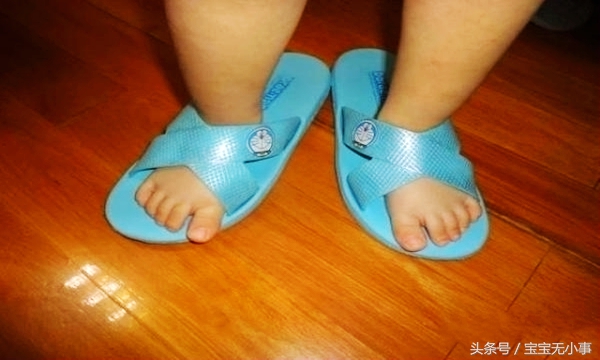 3岁宝宝脚趾头长水泡破裂,三岁小孩脚趾头有水泡像脚气一样