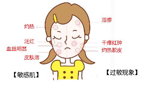 现在皮肤变得越来越敏感了怎么办,28天改善皮肤脆弱敏感