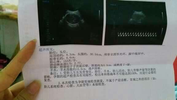 羊水早破怎么办！羊水破了多久会生？