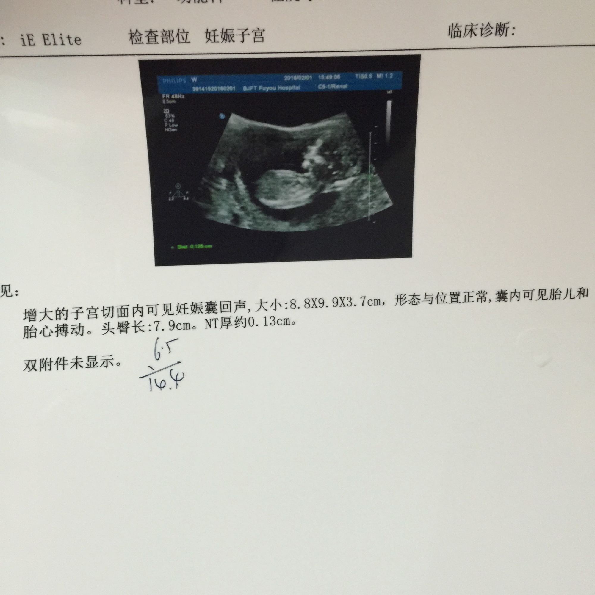 孕期出血的诊疗思路,孕期出血怎么预防感染