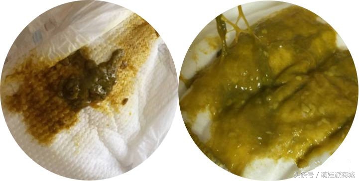 宝宝绿便的十种原因,12种绿便成因