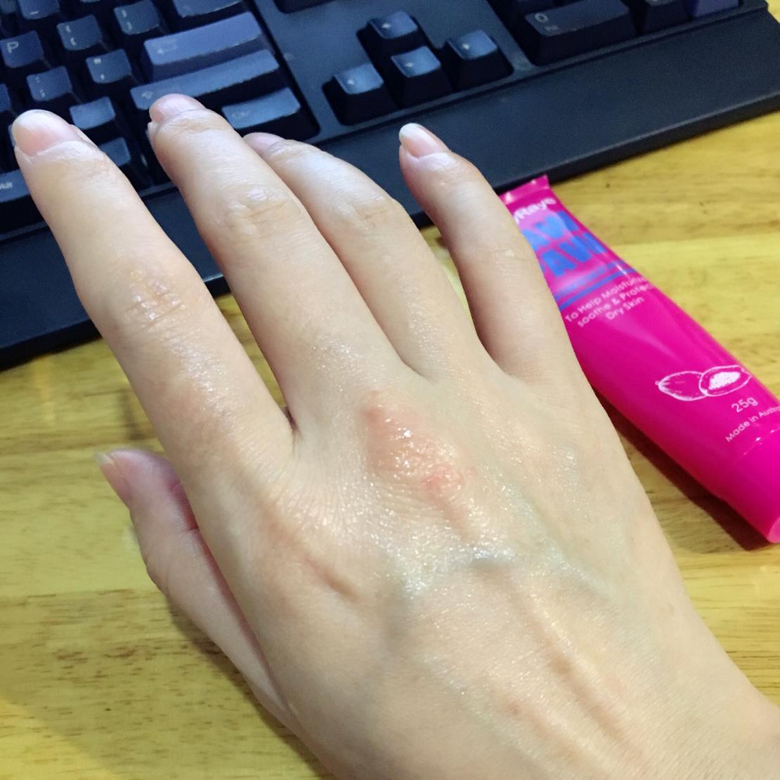 亲身体验的澳洲薇妮芮木瓜膏使用后恨不得推荐给所有人