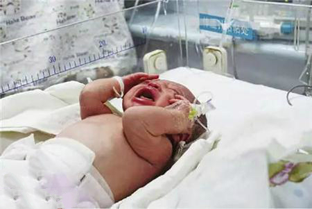 宝宝急产的危险,宝宝最近经常出意外