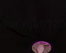 女性尖锐湿疣症状,尖锐性湿疣看什么科