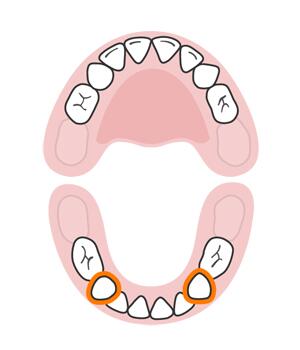 宝宝长牙顺序和换牙顺序一样吗,宝宝换牙有什么征兆