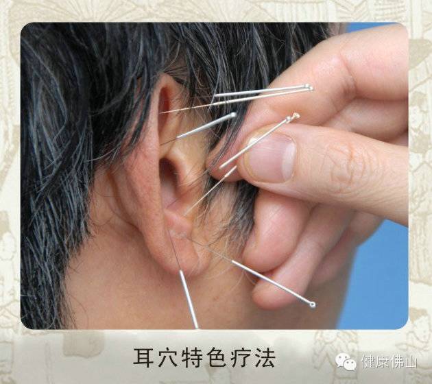 贴士想要A4腰？这里有超全中医饮食减肥法！