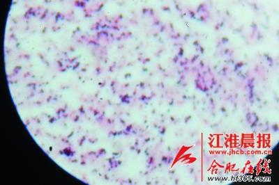 合肥发现新冠病毒,安徽合肥发现一名无症状患者