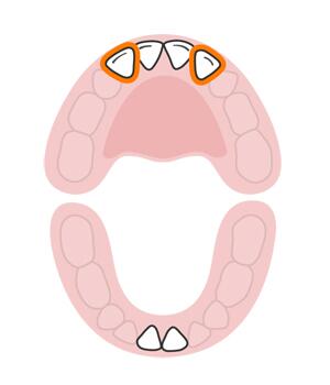 宝宝长牙顺序和换牙顺序一样吗,宝宝换牙有什么征兆