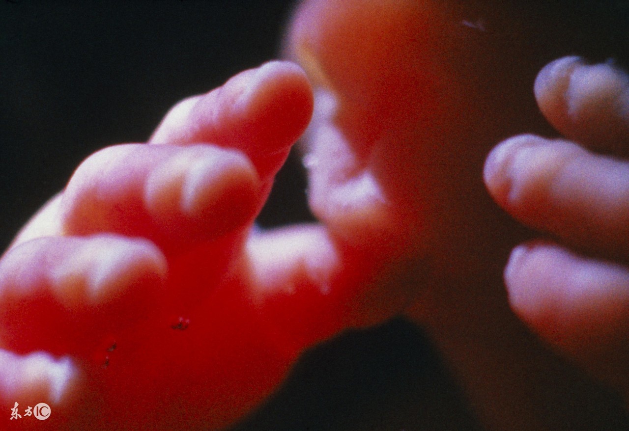 羊水穿刺怎么做的过程,南宁医科大羊水穿刺过程