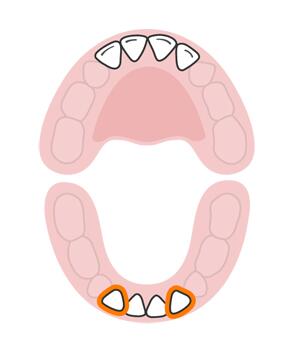 宝宝长牙顺序和换牙顺序一样吗,宝宝换牙有什么征兆