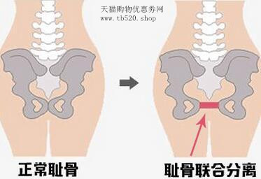 孕期常见症状及缓解技巧,孕妈必懂的8个孕期疼痛缓解方法