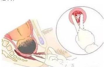 女生顺产时必须面对的五大尴尬,孕妈怕顺产都逃不过这三个原因