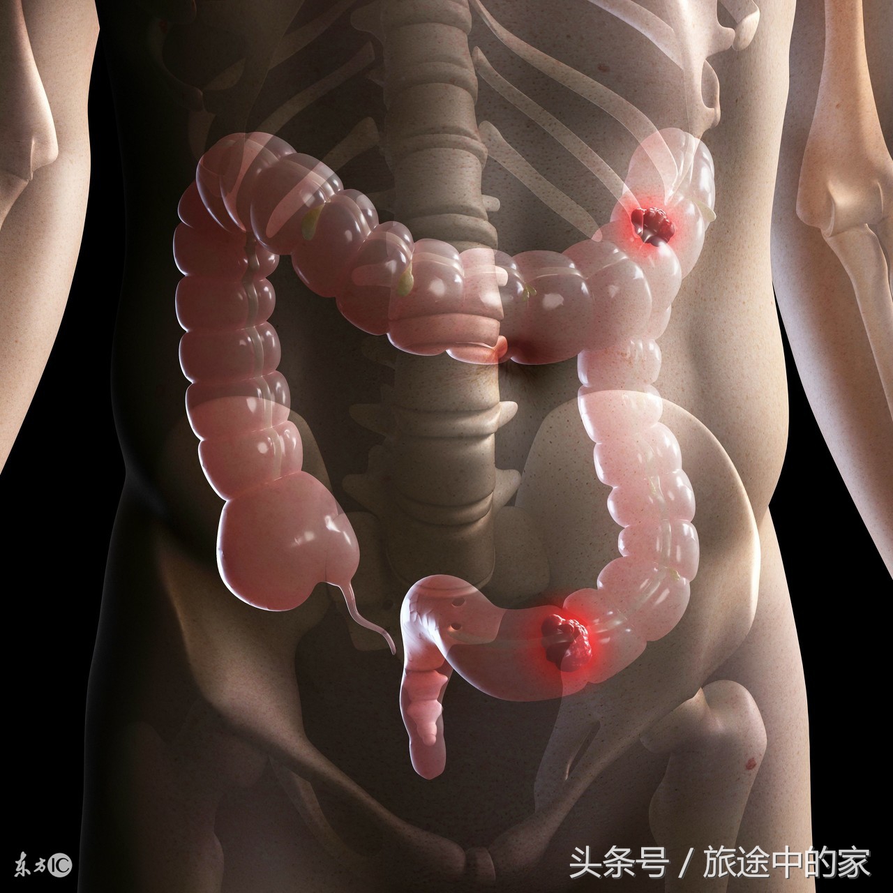 10种常见癌症早期症状知道能救命,这6种高发疾病要当心