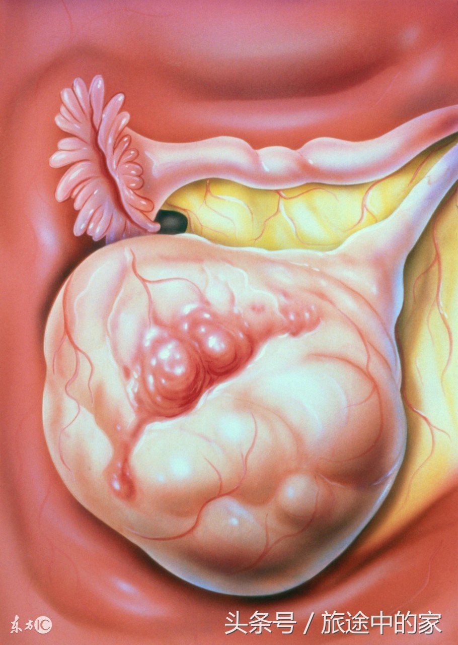 10种常见癌症早期症状知道能救命,这6种高发疾病要当心