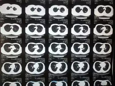 一起学看片儿：X光、CT、核磁，有啥区别？看完就懂了！