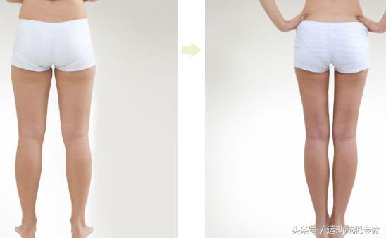 瘦小腿运动后小腿壮,小腿又粗又壮怎么瘦