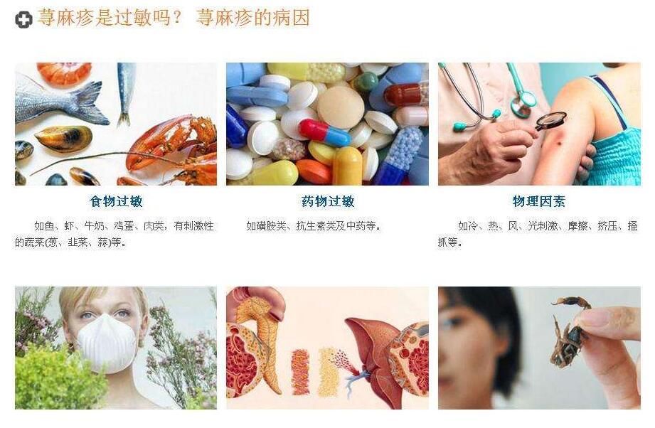 益敏佳益生菌能改善过敏体质吗,改善婴儿过敏体质的益生菌